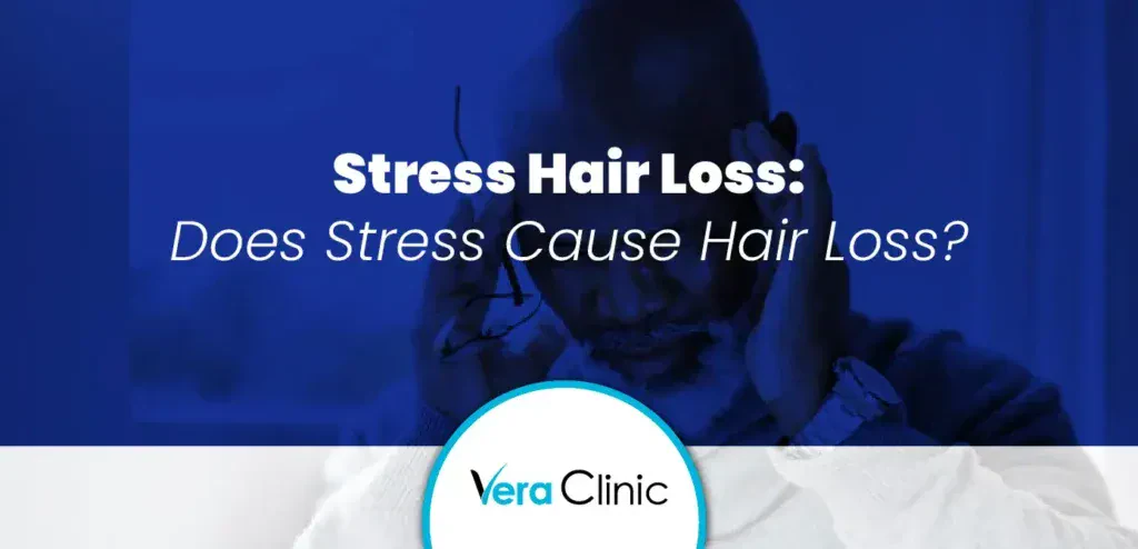 Stress Hair Loss