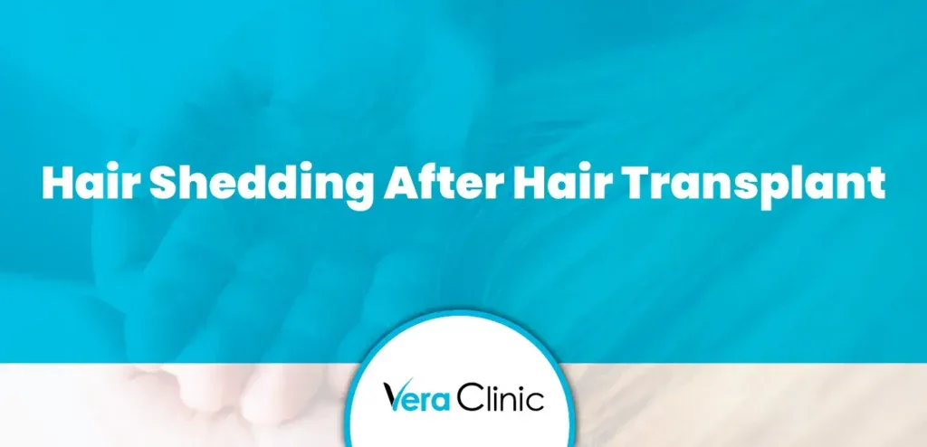 Hair Shedding After Hair Transplant