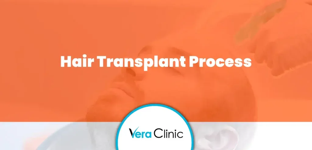 Hair Transplant Process