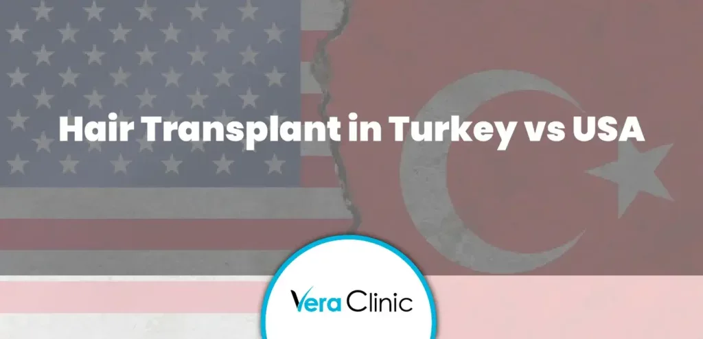 Hair Transplant in Turkey vs USA