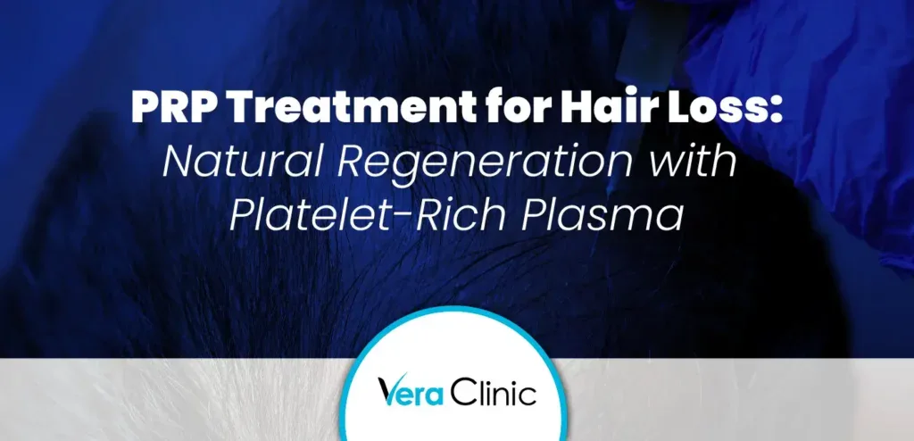 PRP Treatment for Hair Loss