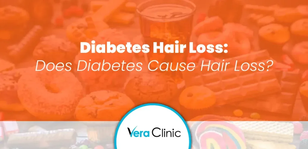Diabetes Hair Loss