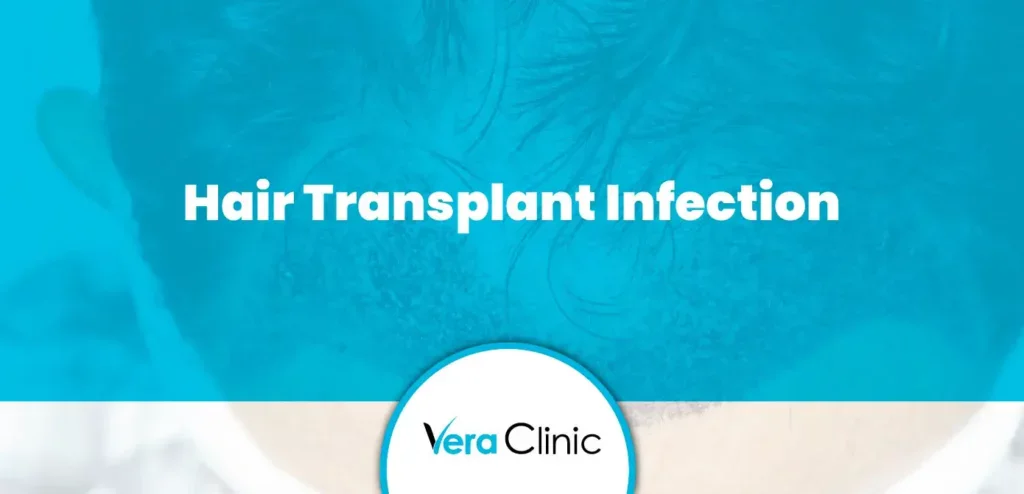 Hair Transplant Infection