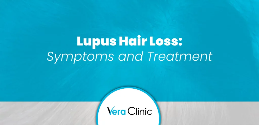 Lupus Hair Loss: Symptoms and Treatment