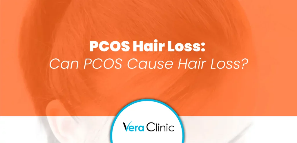PCOS Hair Loss