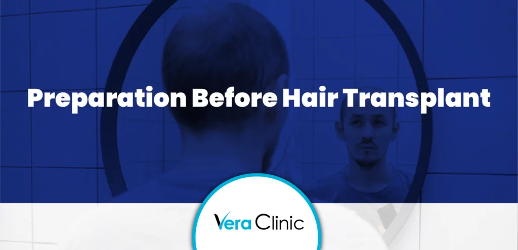 preparation-before-hair-transplant