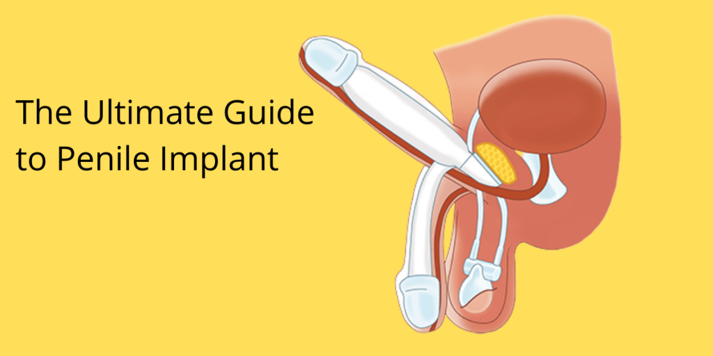 Penile Implant