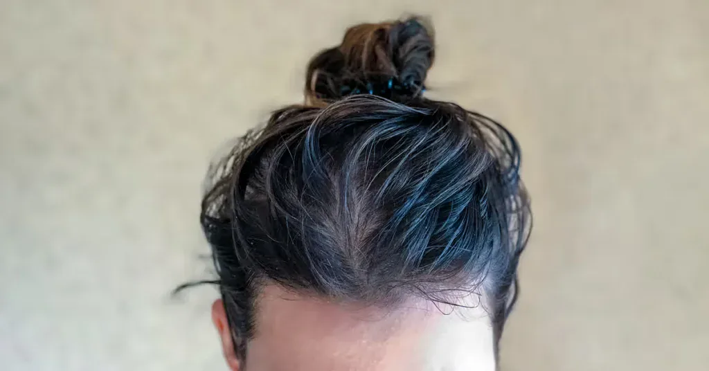 Fettige Haare verstehen