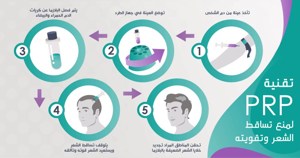 PRP بلازما الشعر