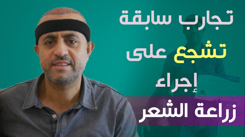 Results of hair transplantation in Turkey