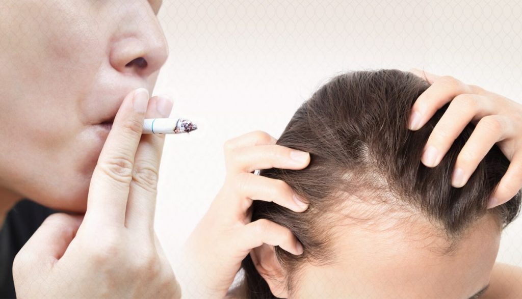 The effect of smoking on increasing the rate of hair loss in women