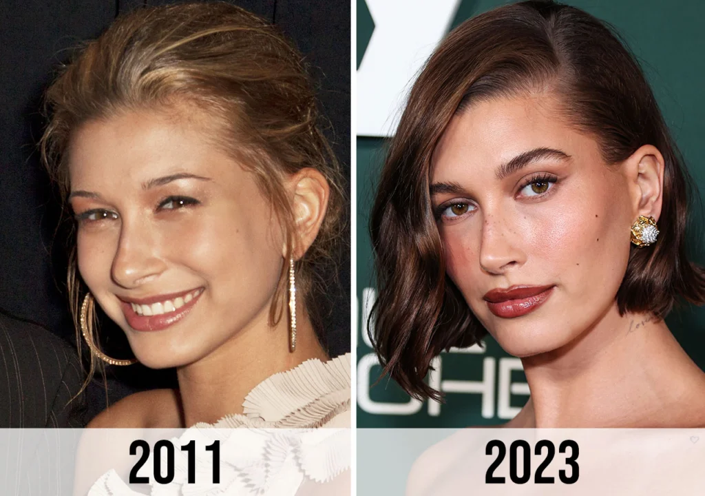 Hailey Bieber Nose Job