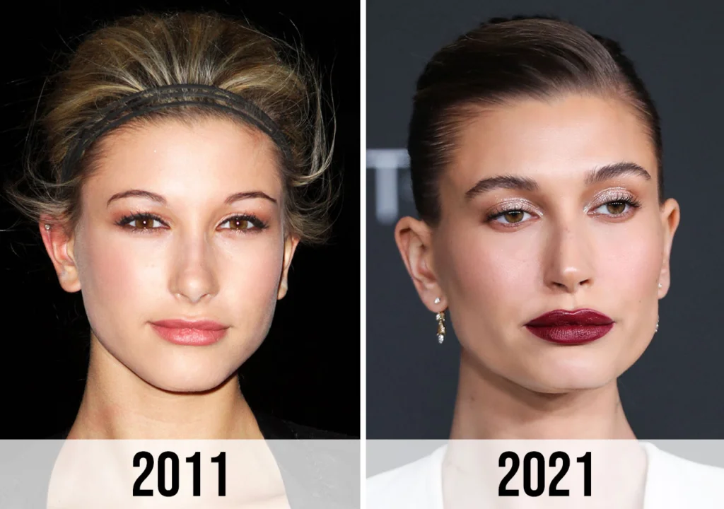 Hailey Bieber Before Plastic Surgery