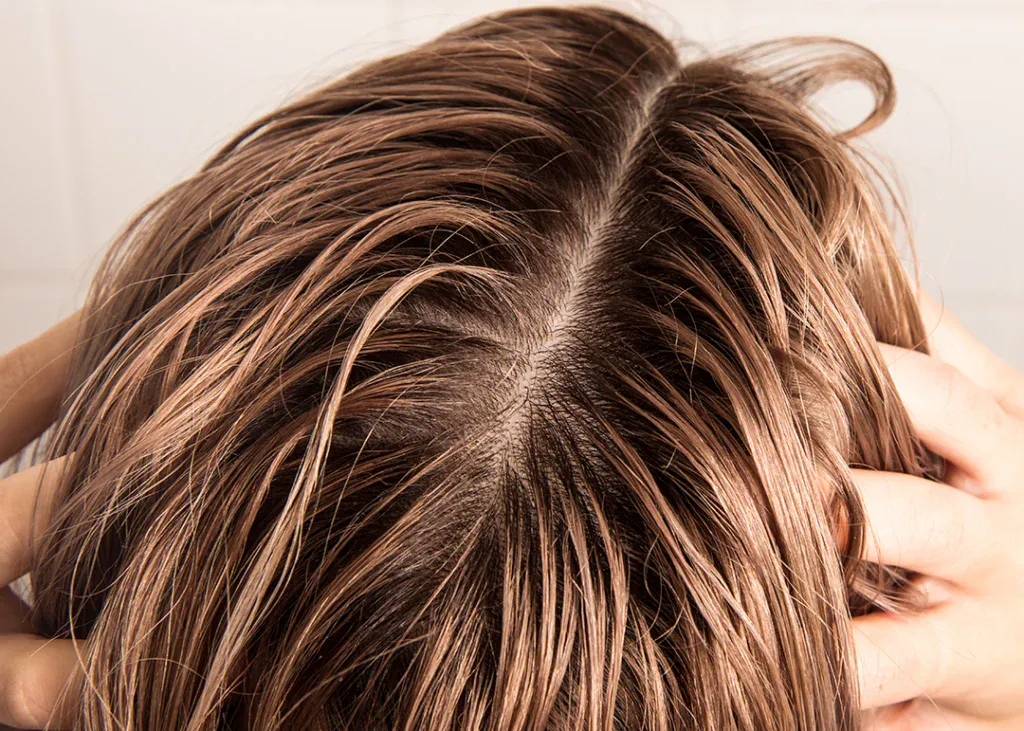 Zusätzliche Tipps zur Behandlung von Frisuren Fettige Haare