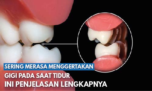 Kenapa saat Tidur Menggertakkan Gigi? Temukan Alasannya Disini!