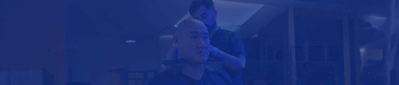 Stem Cell Hair Transplant: Stem Cell for Hair Restoration