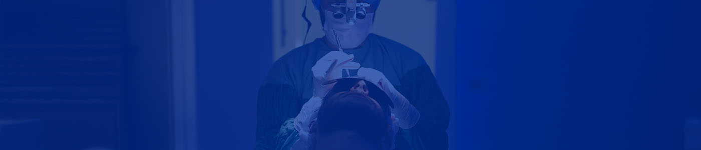 Moustache Transplant