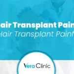 Hair Transplant Pain: Is Hair Transplant Painful?