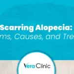 Scarring Alopecia