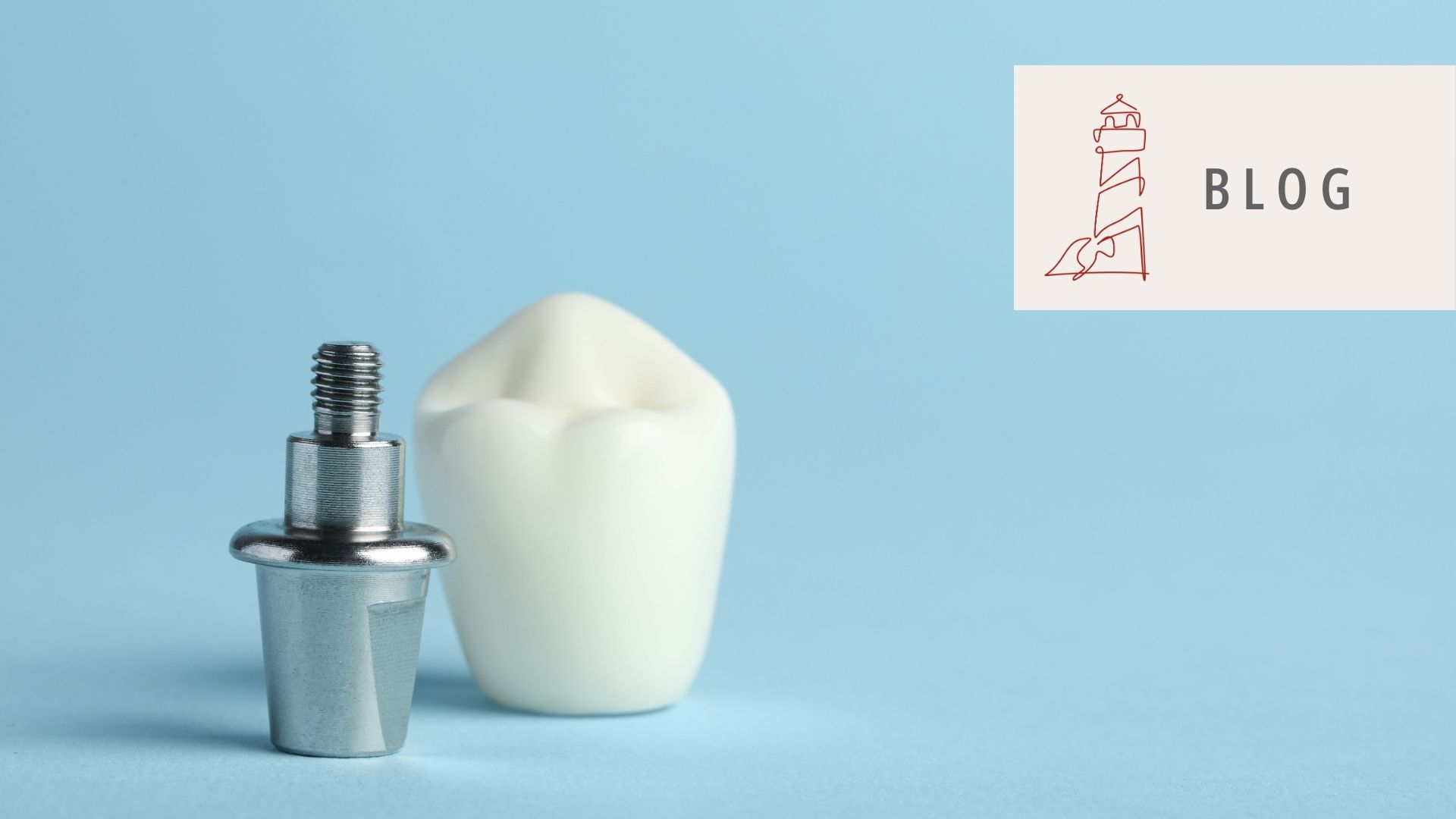 Regelversorgung, gleichartiger oder andersartiger Zahnersatz? Mit dieser Eselsbrücke fällt dir die Einordnung leichter.