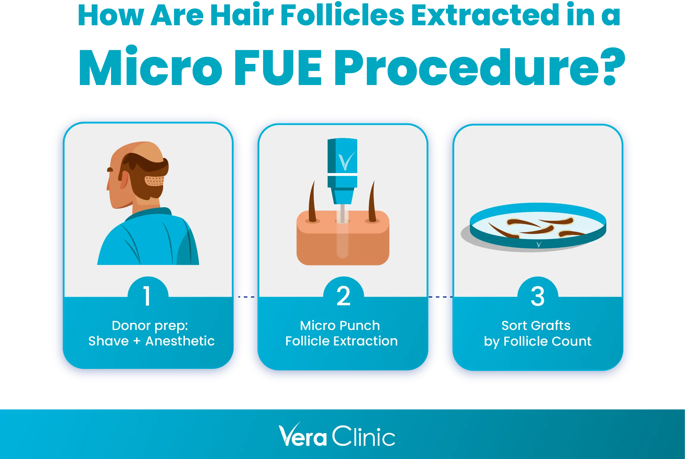 How Are Hair Follicles Extracted in a Micro FUE Procedure