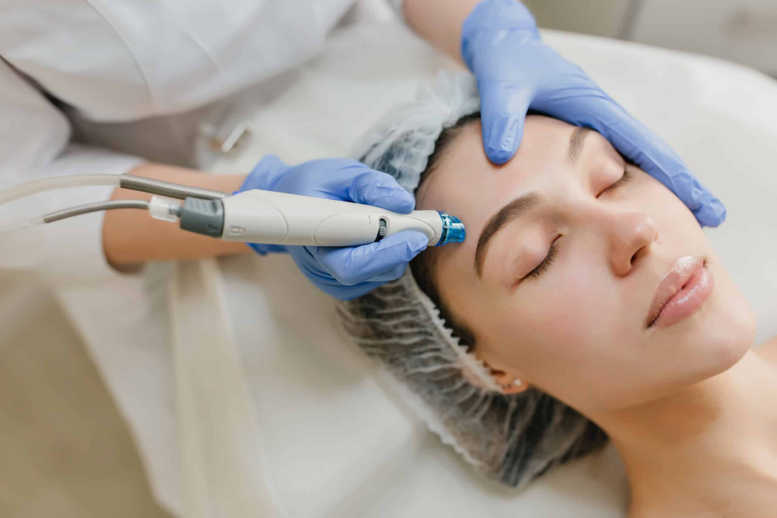 Read more about the article Hydrafacial Benefits for Acne-Prone Skin