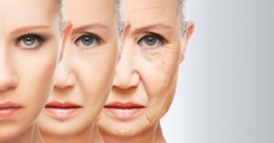 Read more about the article STEPS TO HELP PREVENT AND SLOW DOWN SKIN SAGGING