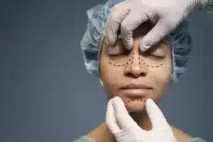 Read more about the article Rise of Celebrity Noses: Rhinoplasty in Chandigarh Trending!