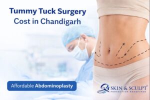 Read more about the article Tummy Tuck Surgery Cost in Chandigarh: Procedure, Recovery, Clinics & Affordable Options