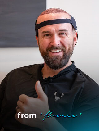 Hair transplant journey to Turkey from France