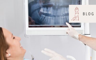 Die optimale ZE-Planung