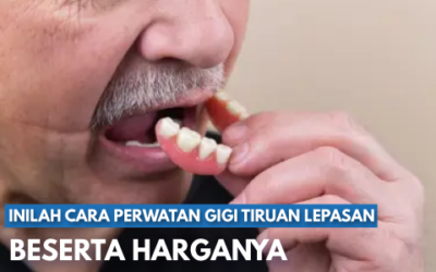 Mengenal Gigi Tiruan Lepasan Beserta Harga dan Cara Merawatnya