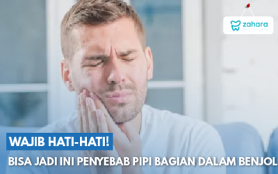 Terdapat Benjolan pada Pipi Bagian Dalam? Wajib Waspada, Jangan-Jangan Ini Penyebabnya!
