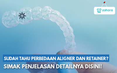 Tidak Sama, Inilah Perbedaan Aligner dan Retainer yang Wajib Anda Pahami