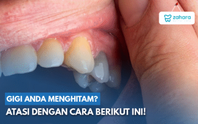 Gigi Hitam Jangan Diabaikan, Ini Penyebab dan Cara Mengembalikan Warnanya