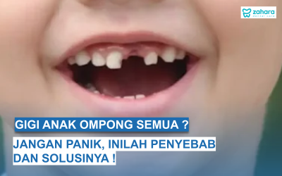 Gigi Anak Ompong Semua? Temukan Penyebab dan Solusi Mengatasinya Disini!