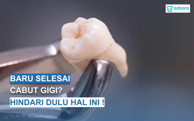 Pantangan Setelah Cabut Gigi: Hal yang Tidak Boleh Dilakukan agar Cepat Sembuh