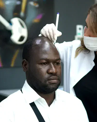 Afro Hair Transplant Costs in Turkey