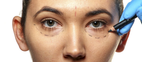 aesthetische-chirurgie Augen Lidchirurgie Lidprobleme Ästhetische Chirurgie Augen Lider, OP
