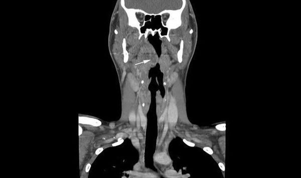 Tomografía de Cuello con contraste - PREVENTOR - Ecografías, Mamografía