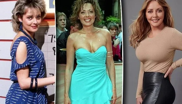 Carol Vorderman Before and After Plastic Surgery