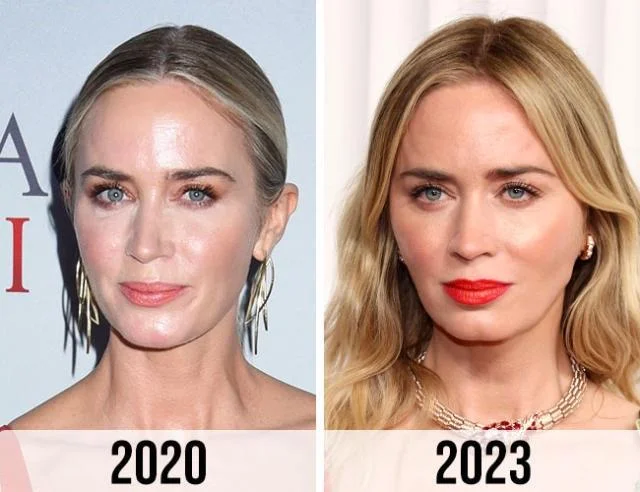 Emily Blunt Before and After Plastic Surgery: A Visual Analysis