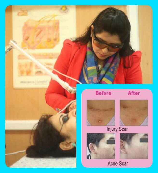 You are currently viewing SKIN RENEWAL WITH LASERS