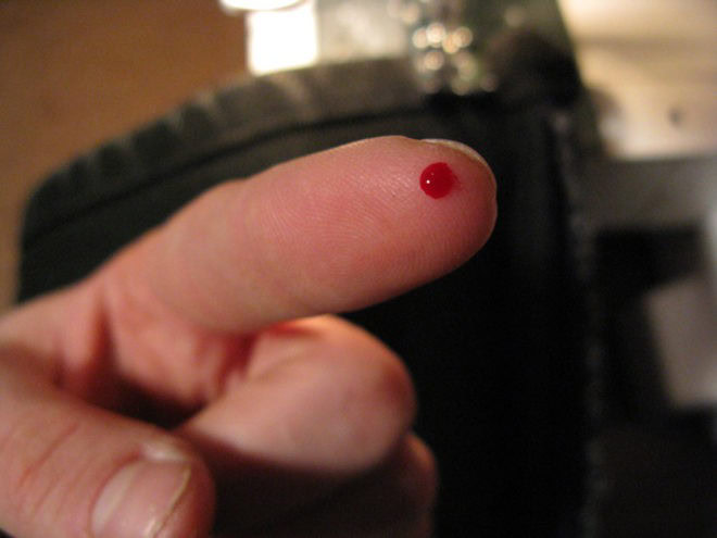 примета уколоться шипом розы. Смотреть фото примета уколоться шипом розы. Смотреть картинку примета уколоться шипом розы. Картинка про примета уколоться шипом розы. Фото примета уколоться шипом розы