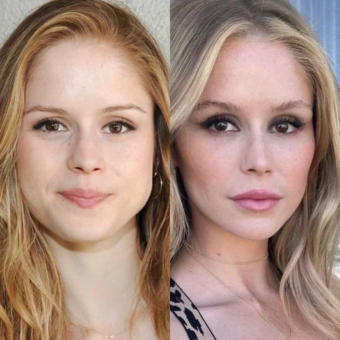 Erin Moriarty's Face: Before and After