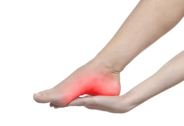 Fascite Plantar