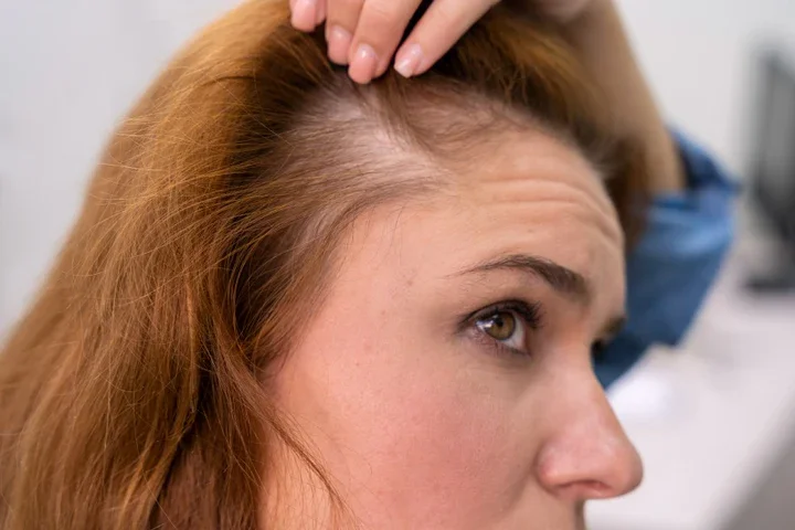 Dünnes Haar Kopfhaut sichtbare Frauenfrisuren zur Transformation