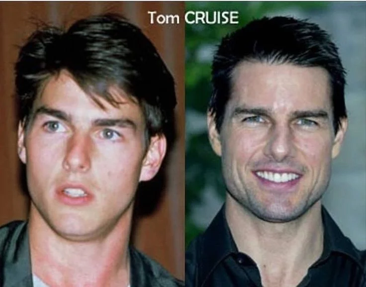 Comparing Tom Cruise's Nose Before and After Surgery