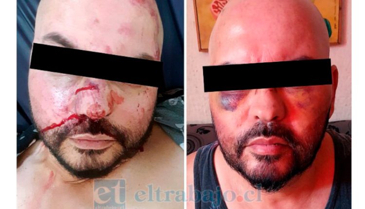 ataque homofóbico
