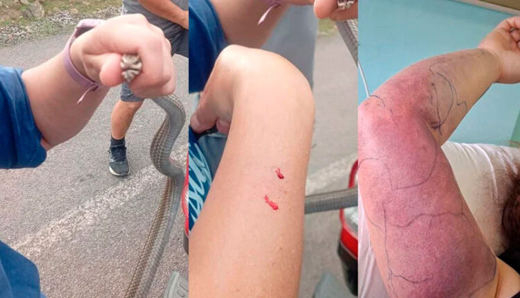 mordida por una culebra